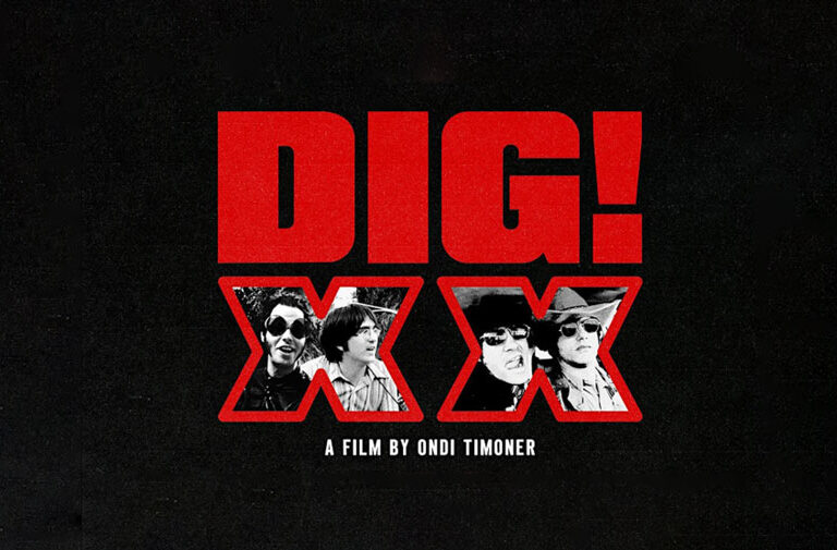 DIG-XX