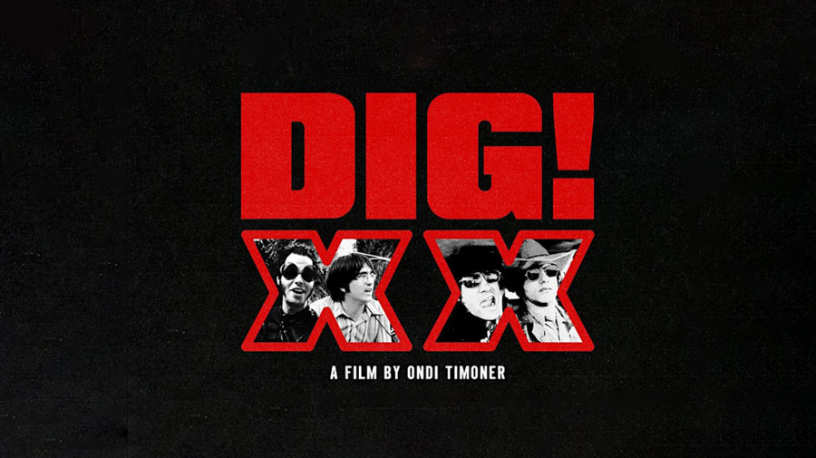DIG-XX